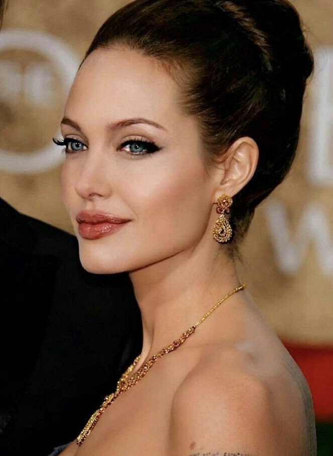 Коррекция овала лица (Профиль Джоли)